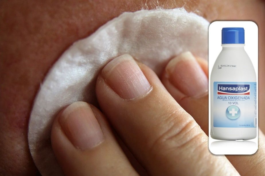 ¿Cómo quitar manchas de tinte de la piel?